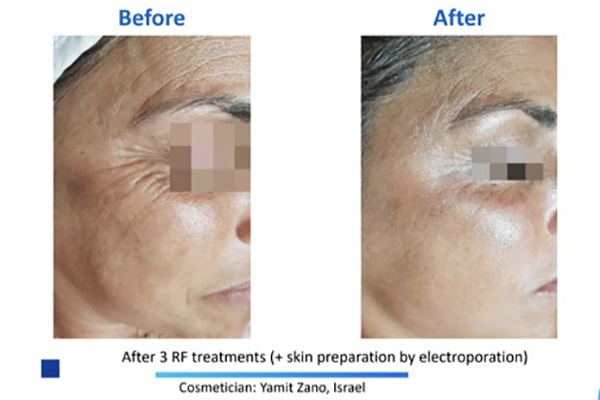 Apollo Duet Training